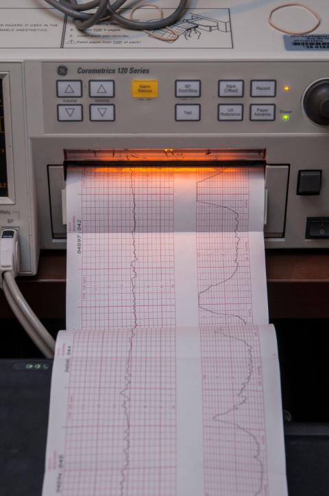 A fetal monitor checks the maternal vital signs of a woman getting ready to have a baby. (Grist/Education Images/Universal Images Group via Getty Images)