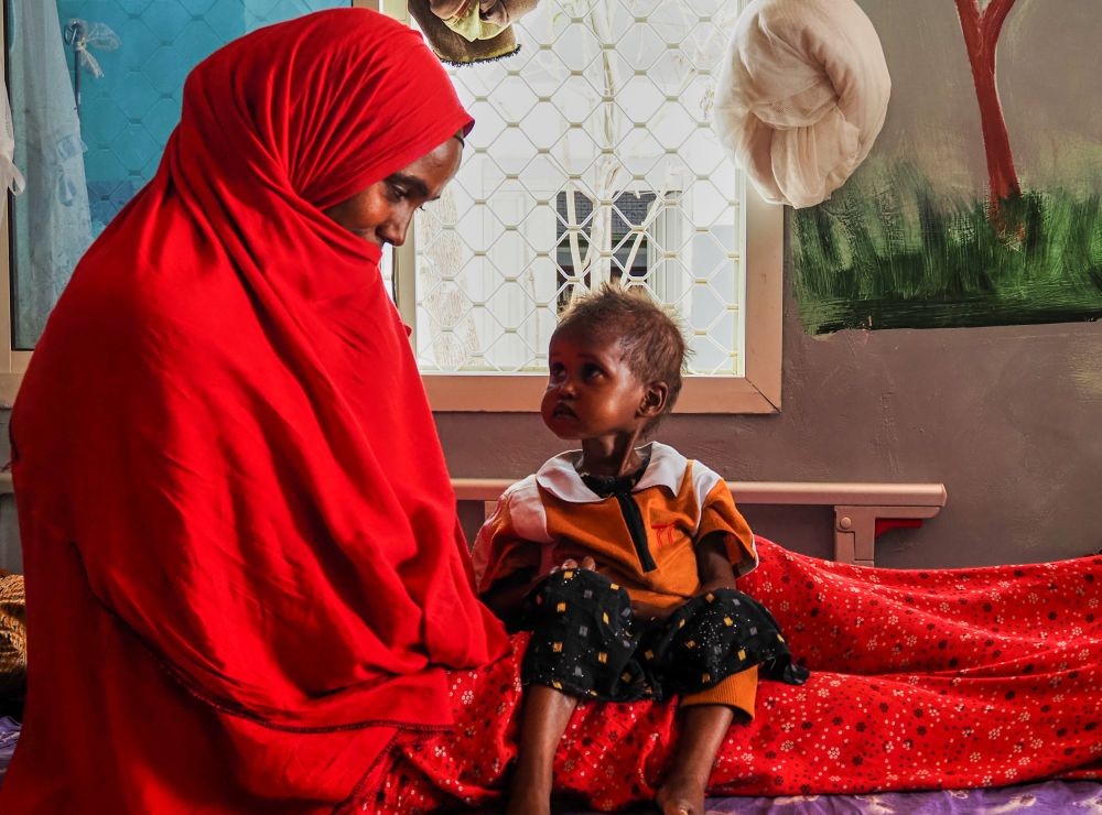 A mother looks at her daughter, who is suffering from severe acute malnutrition, at a stabilization center in a hospital in Qardho, Puntland, Somalia, April 17, 2026. (AP/Jack Denton)